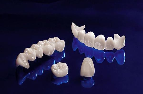 TUỔI THỌ CỦA RĂNG TOÀN SỨ VENUS